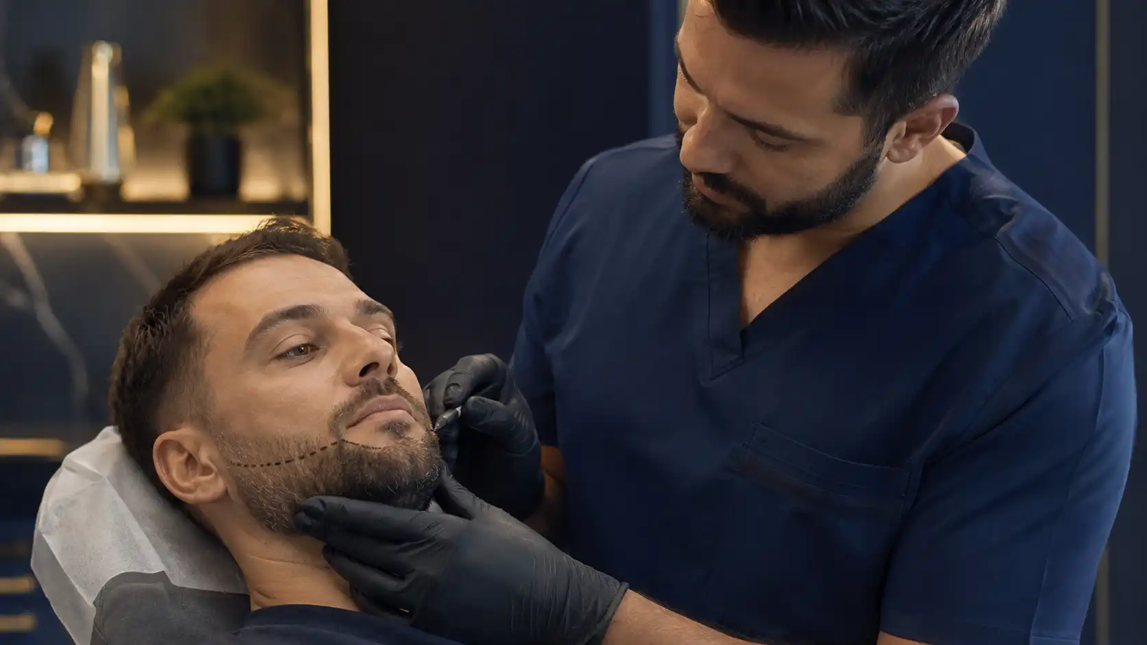 Barttransplantation