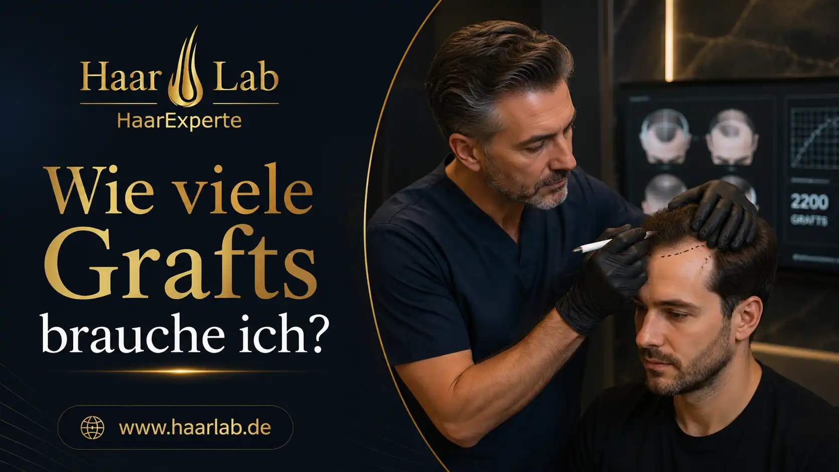 Wie viele Grafts brauche ich?