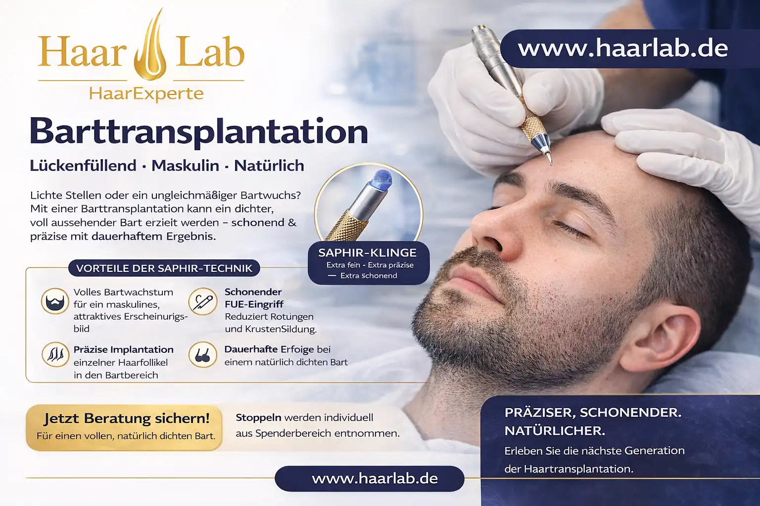 Barttransplantation