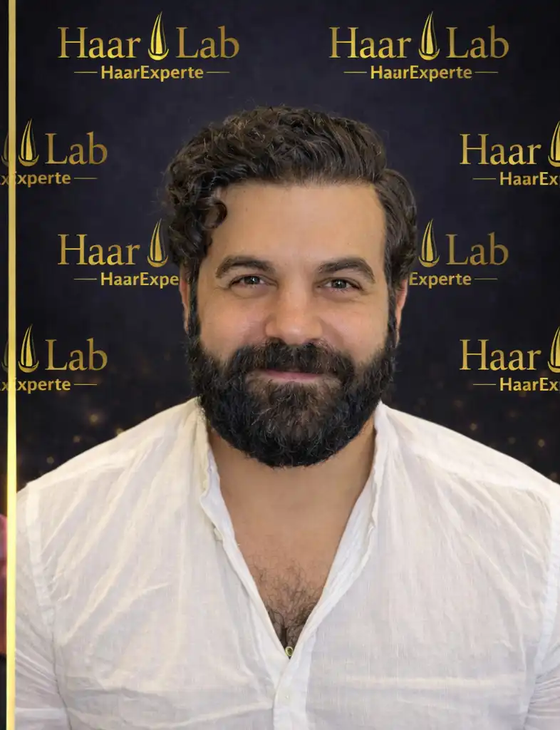 Haartransplantation Mannheim nachher