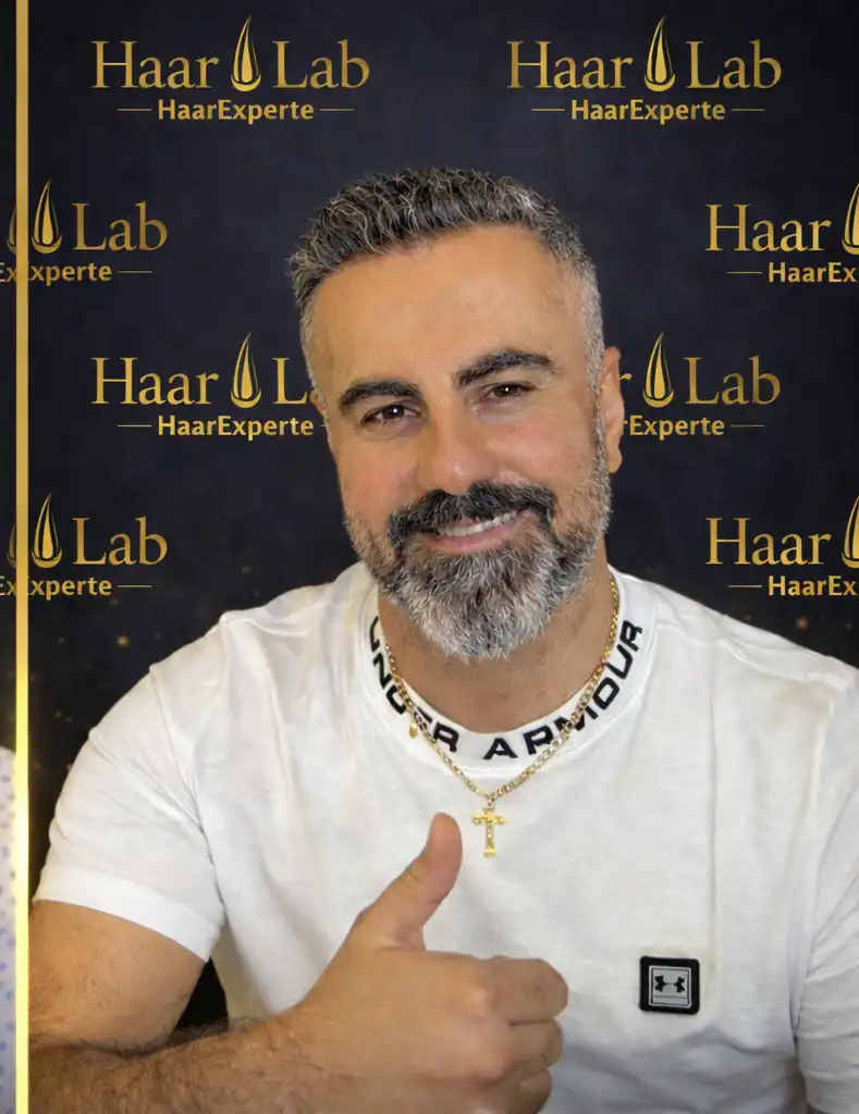 Haartransplantation Mannheim nachher